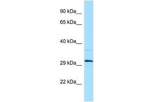 WB Suggested Anti-LILRA5 Antibody Titration: 1. (LILRA5 anticorps  (N-Term))