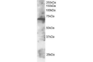 Image no. 1 for anti-SWAP Switching B-Cell Complex 70kDa Subunit (SWAP70) (C-Term) antibody (ABIN374192) (SWAP70 anticorps  (C-Term))