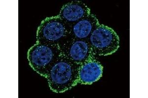 Confocal immunofluorescent analysis of BMPR1A antibody with 293 cells followed by Alexa Fluor 488-conjugated goat anti-rabbit lgG (green).
