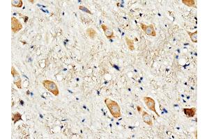 Anti-Dopamine Receptor D3 antibody, IHC(P) IHC(P): Rat Brain Tissue