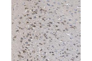 IHC analysis of PNPT1 using anti-PNPT1 antibody (ABIN7599172).