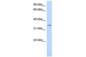 Image no. 1 for anti-Progestin and AdipoQ Receptor Family Member VI (PAQR6) (AA 107-156) antibody (ABIN6743533) (PAQR6 anticorps  (AA 107-156))
