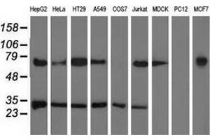 Western blot analysis of extracts (35 µg) from 9 different cell lines by using anti-PYCR2 monoclonal antibody. (PYCR2 anticorps)