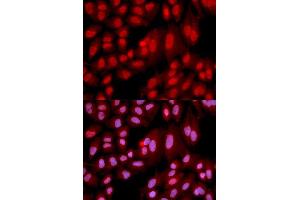Immunofluorescence analysis of U2OS cell using PPP2R2A antibody. (PPP2R2A anticorps  (AA 1-447))