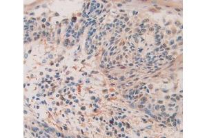 Figure. (QSOX1 anticorps  (AA 394-519))