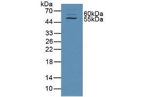 Detection of TXLNa in Rat Skin Tissue using Polyclonal Antibody to Taxilin Alpha (TXLNa) (alpha Taxilin anticorps  (AA 1-234))