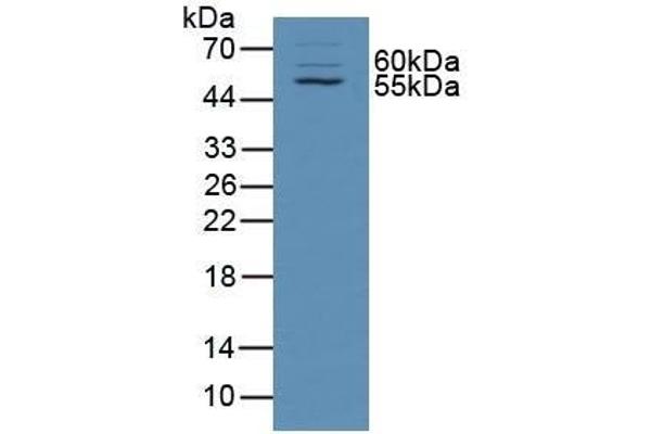 alpha Taxilin Antikörper  (AA 1-234)