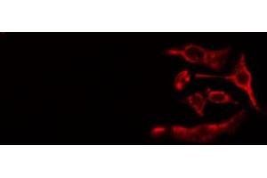 ABIN6267522 staining Hela cells by IF/ICC. (ZAP70 anticorps  (pTyr493))