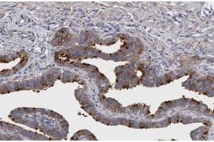 ABIN6267299 at 1/200 staining human Fallopian tube sections by IHC-P. (Integrin beta 3 anticorps  (pTyr773))