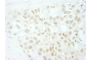 Immunohistochemistry (IHC) image for anti-Makorin Ring Finger Protein 2 (MKRN2) (C-Term) antibody (ABIN7453561)