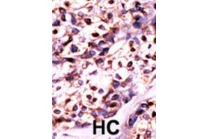 Immunohistochemistry (IHC) image for anti-Uridine-Cytidine Kinase 2 (UCK2) antibody (ABIN3003032) (UCK2 anticorps)