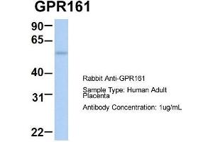 Host:  Rabbit  Target Name:  GPR161  Sample Type:  Human Adult Placenta  Antibody Dilution:  1. (GPR161 anticorps  (Middle Region))