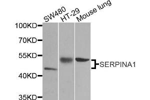 Western blot analysis of extracts of various cell lines, using SERPINA1 antibody. (SERPINA1 anticorps  (AA 25-315))