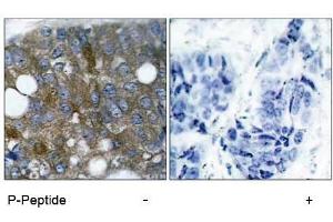 Image no. 1 for anti-Heat Shock 27kDa Protein 1 (HSPB1) (pSer15) antibody (ABIN196894) (HSP27 anticorps  (pSer15))