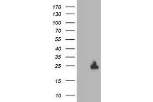 Western Blotting (WB) image for anti-Deoxythymidylate Kinase (Thymidylate Kinase) (DTYMK) antibody (ABIN1497918) (DTYMK anticorps)