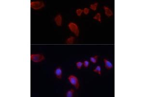 Immunofluorescence analysis of HeLa cells using Carbonic Anhydrase 9 (C/G250) antibody (ABIN6131266, ABIN6137798, ABIN6137800 and ABIN6217767) at dilution of 1:100.