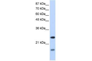 WB Suggested Anti-SRAntibody Titration:  1. (SRP14 anticorps  (N-Term))