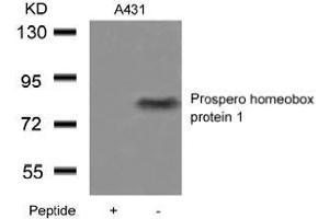 Western blot analysis of extracts from A431 cells using Prospero homeobox protein 1and the same antibody preincubated with blocking peptide.