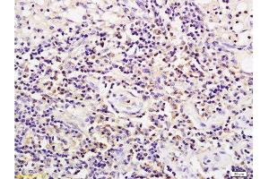 Formalin-fixed and paraffin embedded rat transplant lymphoma labeled with Anti-CD19 Polyclonal Antibody , Unconjugated 1:200 followed by conjugation to the secondary antibody and DAB staining