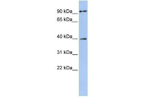 WB Suggested Anti-MAGEA6 Antibody Titration:  0. (MAGEA6 anticorps  (Middle Region))