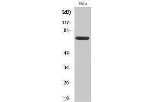 Western Blotting (WB) image for anti-Eukaryotic Translation Initiation Factor 2-alpha Kinase 2 (EIF2AK2) (Thr392) antibody (ABIN3176940) (EIF2AK2 anticorps  (Thr392))