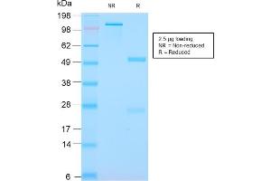 SDS-PAGE Analysis Purified S100A8/A9 Complex Recombinant Rabbit Monoclonal (MAC3157R).