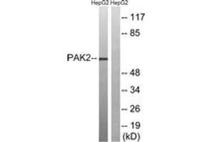 Western blot analysis of extracts from HepG2 cells, treated with serum 20% 15', using PAK2 (Ab-192) Antibody. (PAK2 anticorps  (AA 158-207))