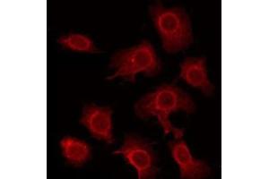 ABIN6275855 staining HeLa by IF/ICC. (STK33 anticorps  (N-Term))
