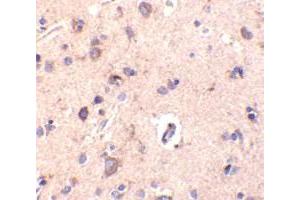 Immunohistochemical staining of human brain tissue using AP30248PU-N CTRP2 antibody at 10 μg/ml.