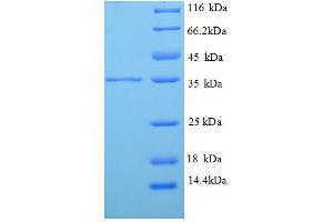 Tropomyosin-2 (TPM2) (AA 14-284), (partial) protein (His tag) (TPM2 Protein (AA 14-284, partial) (His tag))