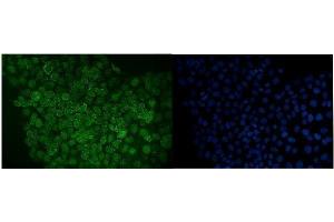 IF analysis of RANGAP1 using anti-RANGAP1 antibody (ABIN7600225).