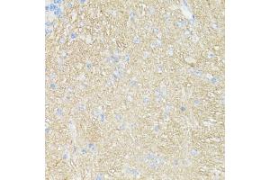 Immunohistochemistry of paraffin-embedded mouse brain using CD90/Thy1 antibody (ABIN7266228) at dilution of 1:100 (40x lens). (CD90 anticorps  (AA 31-81))