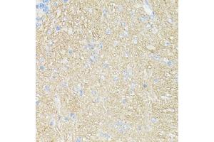 Immunohistochemistry of paraffin-embedded mouse brain using CD90/Thy1 antibody (ABIN7266228) at dilution of 1:100 (40x lens).