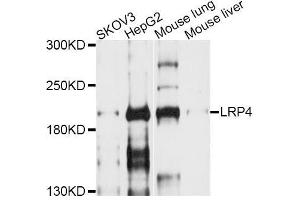 Western blot analysis of extracts of various cell lines, using LRP4 antibody (ABIN6003867) at 1/1000 dilution. (LRP4 anticorps)