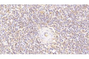 Detection of LOXL3 in Human Spleen Tissue using Polyclonal Antibody to Lysyl Oxidase Like Protein 3 (LOXL3)