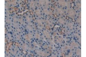 Detection of DKK3 in Mouse Kidney Tissue using Polyclonal Antibody to Dickkopf Related Protein 3 (DKK3)