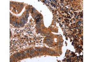 Immunohistochemistry (IHC) image for anti-C-Type Lectin Domain Family 4, Member A (CLEC4A) (AA 70-237) antibody (ABIN6219767) (CLEC4A anticorps  (AA 70-237))