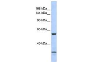 Image no. 1 for anti-Zinc Finger Protein 777 (ZNF777) (AA 91-140) antibody (ABIN6740582) (ZNF777 anticorps  (AA 91-140))