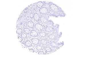 colon descendens mucosa (CPA1 anticorps)