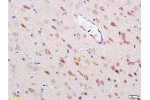 Immunohistochemistry (Paraffin-embedded Sections) (IHC (p)) image for anti-Heat Shock Protein 70 (HSP70) (AA 481-534) antibody (ABIN725360)