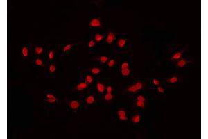 ABIN6268793 staining 293 by IF/ICC. (GATA4 anticorps  (Internal Region))