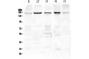 Western blot analysis of EEA1 using anti-EEA1 antibody . (EEA1 anticorps)
