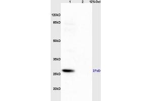 Lane 1: mouse brain lysates Lane 2: mouse pancreas lysates probed with Anti Phospho-S6 Ribosomal Protein (Ser235+Ser236) Polyclonal Antibody, Unconjugated (ABIN745583) at 1:200 in 4 °C. (RPS6 anticorps  (pSer235, pSer236))