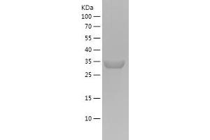Western Blotting (WB) image for Actin, alpha 1, Skeletal Muscle (ACTA1) (AA 81-140) protein (His-IF2DI Tag) (ABIN7121657)