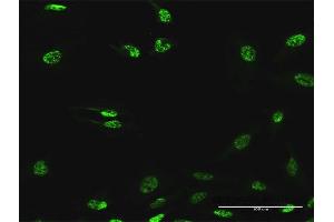 Immunofluorescence of purified MaxPab antibody to SF3B2 on HeLa cell.