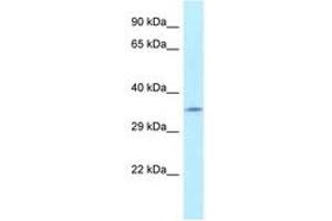 Image no. 1 for anti-Fumarylacetoacetate Hydrolase Domain Containing 2A (FAHD2A) (AA 28-77) antibody (ABIN6747792) (FAHD2A anticorps  (AA 28-77))