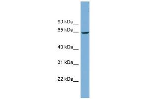 WB Suggested Anti-RACGAP1 Antibody Titration:  0. (RACGAP1 anticorps  (N-Term))