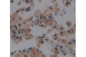 Used in DAB staining on fromalin fixed paraffin- embedded Kidney tissue