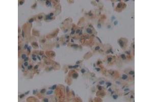 Used in DAB staining on fromalin fixed paraffin- embedded Kidney tissue (Endothelin 2 anticorps  (AA 32-178))