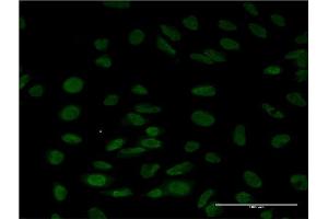 Immunofluorescence of monoclonal antibody to LSM6 on HeLa cell.
